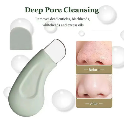 Blackhead & Whitehead Removal Tool – Nose & Face Pore Cleaner for Women